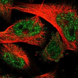 THEM6 Antibody, Novus Biologicals 25 &mu;L | Buy Online | Novus Biologicals | Fisher Scientific